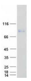 SDS-PAGE (LTF-1062HFL).jpg